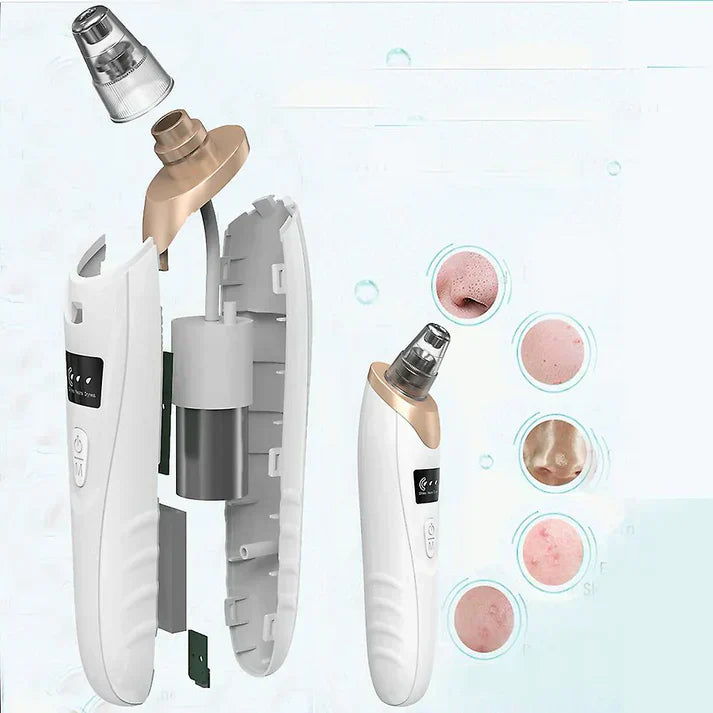 Electric Face Vacuum Blackhead Remover & Pore Cleaner | Deep Cleansing Tool for Nose and Face - SS Smart Store