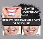 Charcoal Teeth Whitening Powder Deep Cleansing - SS Smart Store