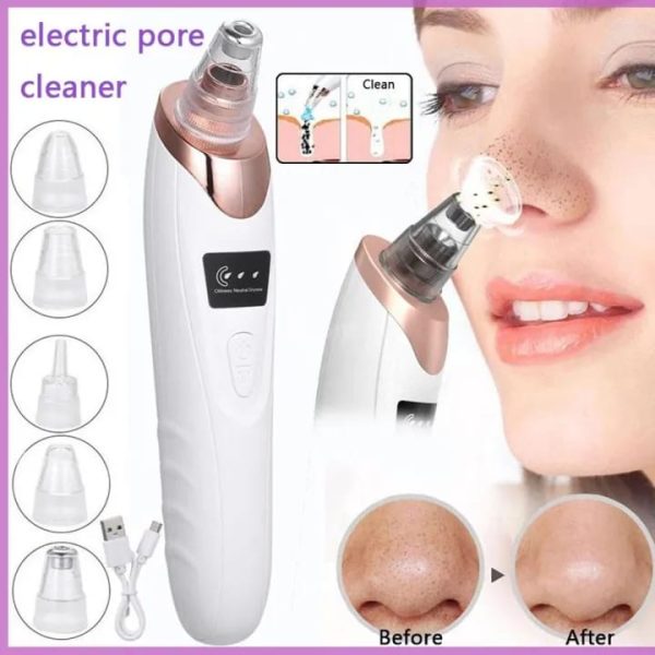 Electric Face Vacuum Blackhead Remover & Pore Cleaner | Deep Cleansing Tool for Nose and Face - SS Smart Store